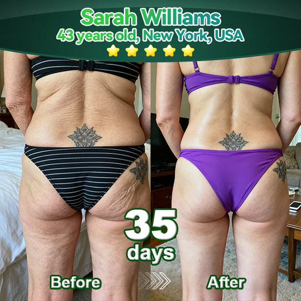 𝐿𝑜𝑡𝑚𝑎𝑦® 𝑆𝑡𝑒𝑚 𝐶𝑒𝑙𝑙 & 𝐶𝑜𝑙𝑙𝑎𝑔𝑒𝑛 𝑃𝑒𝑝𝑡𝑖𝑑𝑒 𝑂𝑟𝑎𝑙 𝐷𝑟𝑜𝑝𝑠  (Levanta y reafirma la piel flácida y reduce la formación de arrugas) 🌞