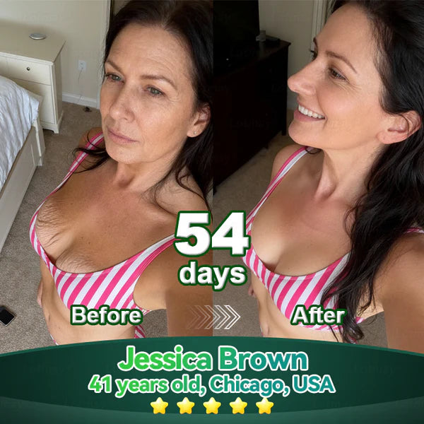 𝐿𝑜𝑡𝑚𝑎𝑦® 𝑆𝑡𝑒𝑚 𝐶𝑒𝑙𝑙 & 𝐶𝑜𝑙𝑙𝑎𝑔𝑒𝑛 𝑃𝑒𝑝𝑡𝑖𝑑𝑒 𝑂𝑟𝑎𝑙 𝐷𝑟𝑜𝑝𝑠  (Levanta y reafirma la piel flácida y reduce la formación de arrugas) 🌞