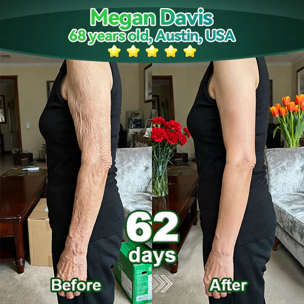 𝐿𝑜𝑡𝑚𝑎𝑦® 𝑆𝑡𝑒𝑚 𝐶𝑒𝑙𝑙 & 𝐶𝑜𝑙𝑙𝑎𝑔𝑒𝑛 𝑃𝑒𝑝𝑡𝑖𝑑𝑒 𝑂𝑟𝑎𝑙 𝐷𝑟𝑜𝑝𝑠  (Levanta y reafirma la piel flácida y reduce la formación de arrugas) 🌞