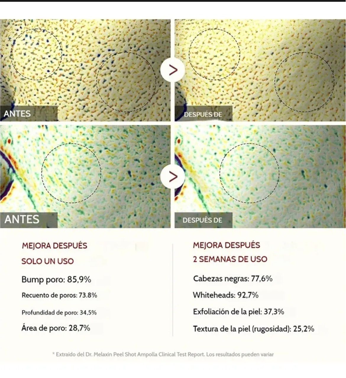 SKINPRO⭐⭐⭐⭐⭐Serum de arroz