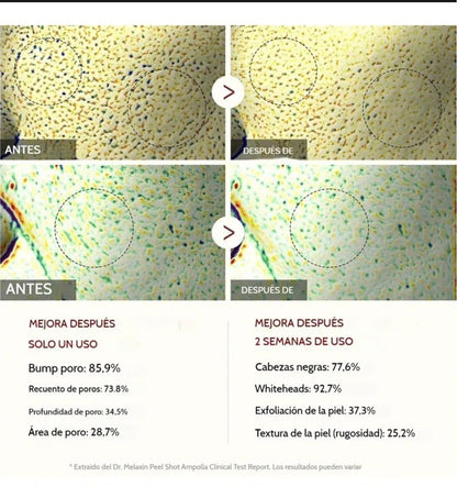 SKINPRO⭐⭐⭐⭐⭐Serum de arroz